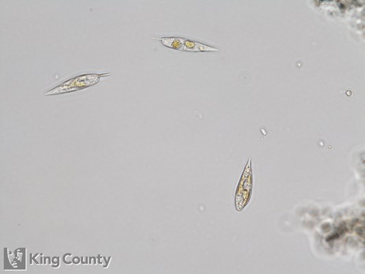 Photo of Prorocentrum gracile